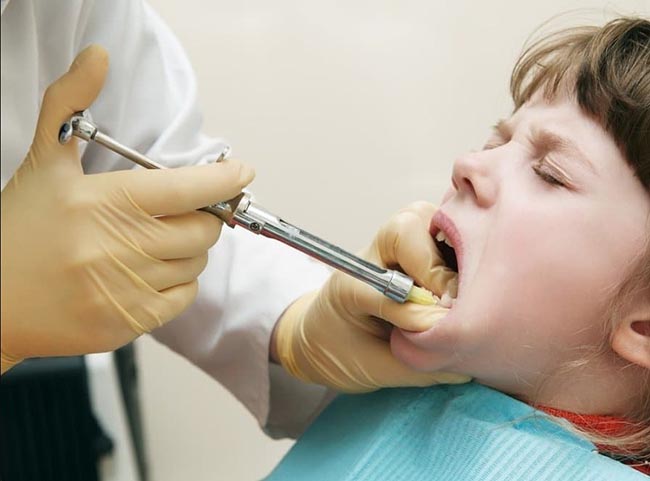 Местное обезболивание в стоматологии: почему лечить зубы уже не страшно