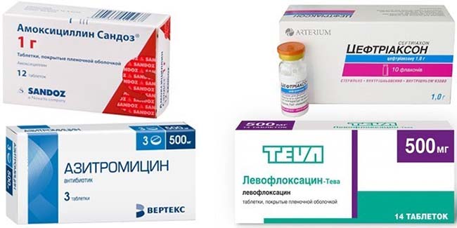 Какие требования предъявляются к антибиотикам от пневмонии Какие требования предъявляются к антибиотикам от пневмонии