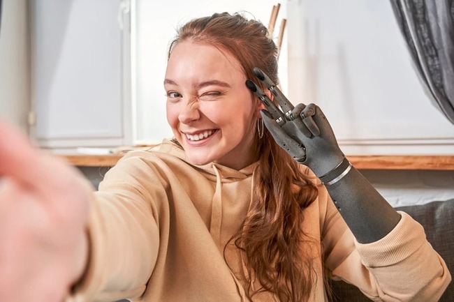 Сучасний протез верхньої кінцівки